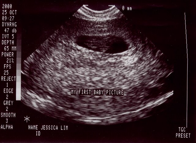 My first picture!!!