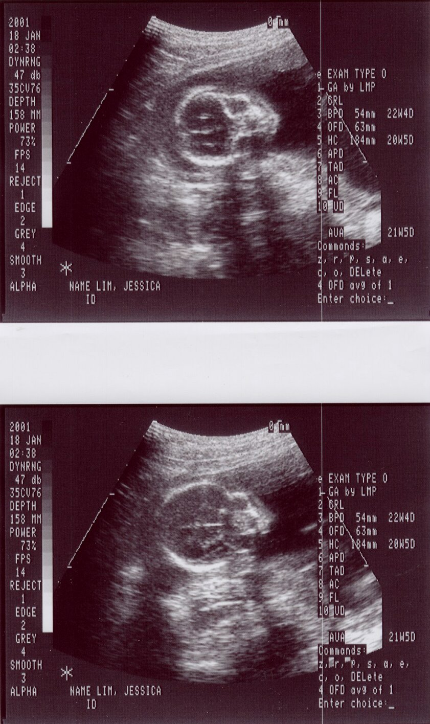 20 weeks old