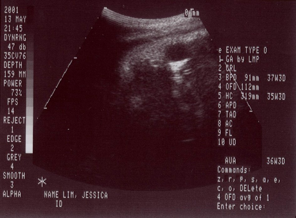 37 weeks old